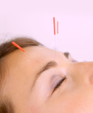 Akupunktur und Akupunktmassage